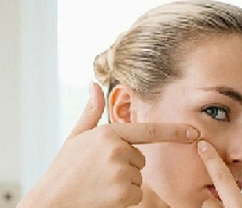 5 nguyên nhân gây mụn trứng cá ở tuổi teen