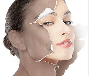 4 cách chống nám da hiệu quả bạn nên biết