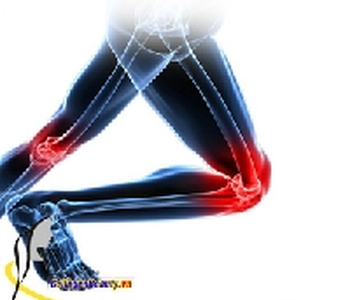 Viêm xương khớp và những điều có thể bạn chưa biết