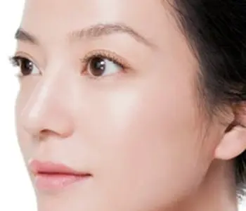 Nám da hai bên má có tự hết không khi sinh em bé xong? - Viên uống trị nám LCE