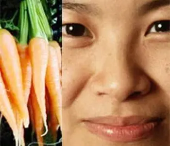 Cà rốt và dầu ăn - liệu pháp chăm sóc da nám cho các mẹ