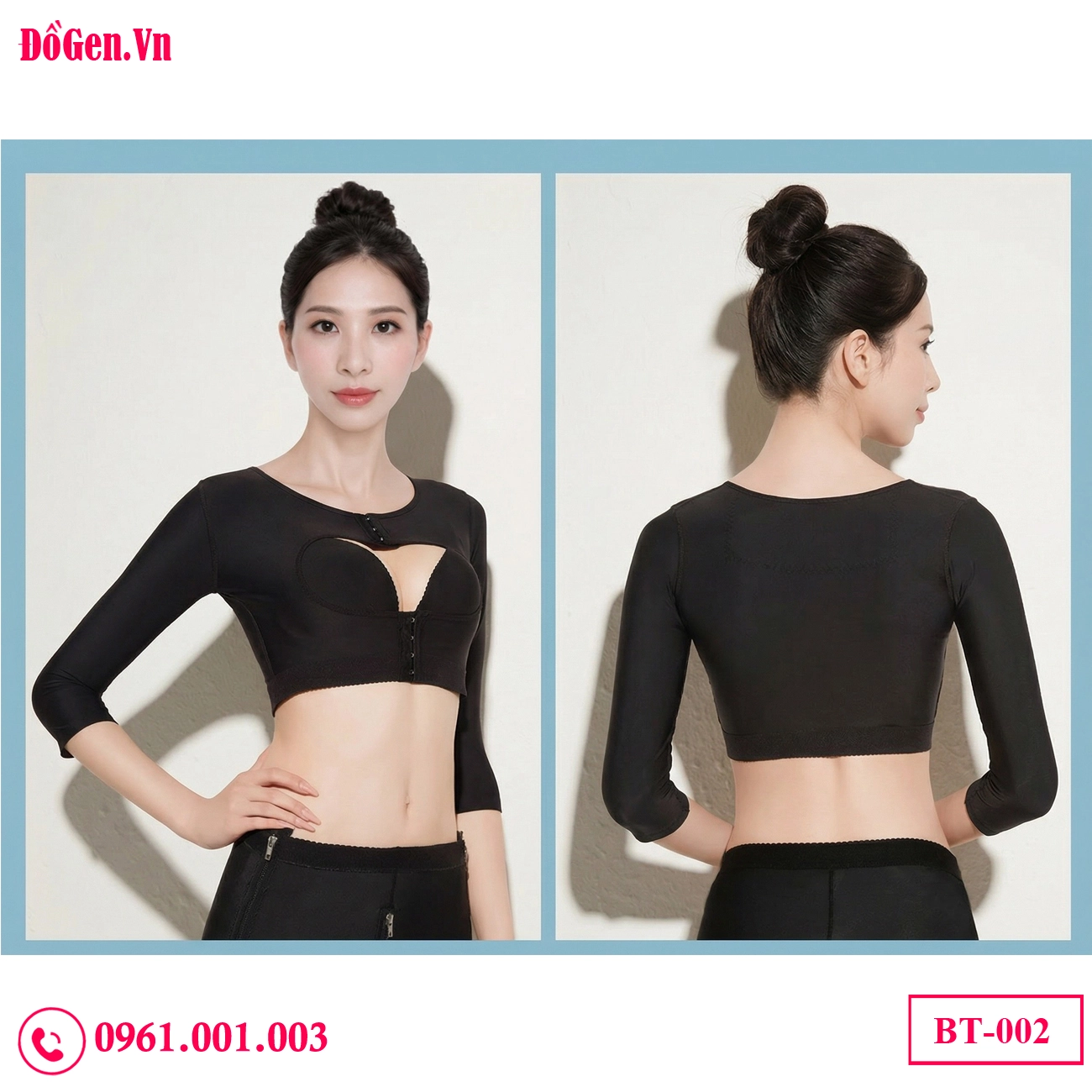 Post-op arm liposuction garment effectively reducing bruising and promoting faster recovery. Post-op arm liposuction garment effectively reducing bruising and promoting faster recovery.