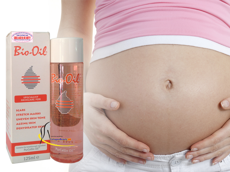  Tinh dầu trị rạn da Bio Oil làm giảm thiểu các vết rạn da trong thai kỳ hay tăng cân quá nhanh
